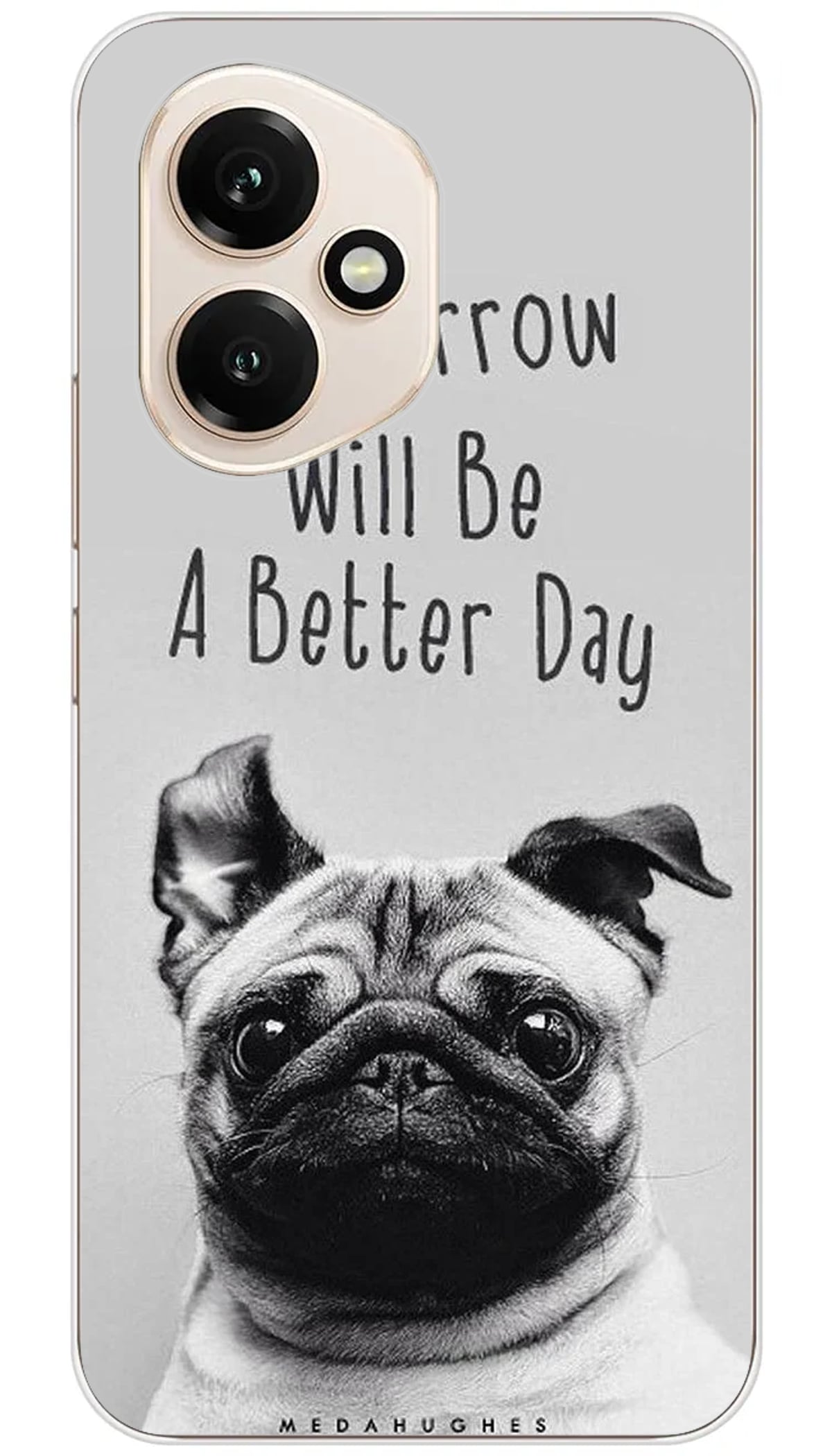 Coque Huawei Citation 17 - Honor 400