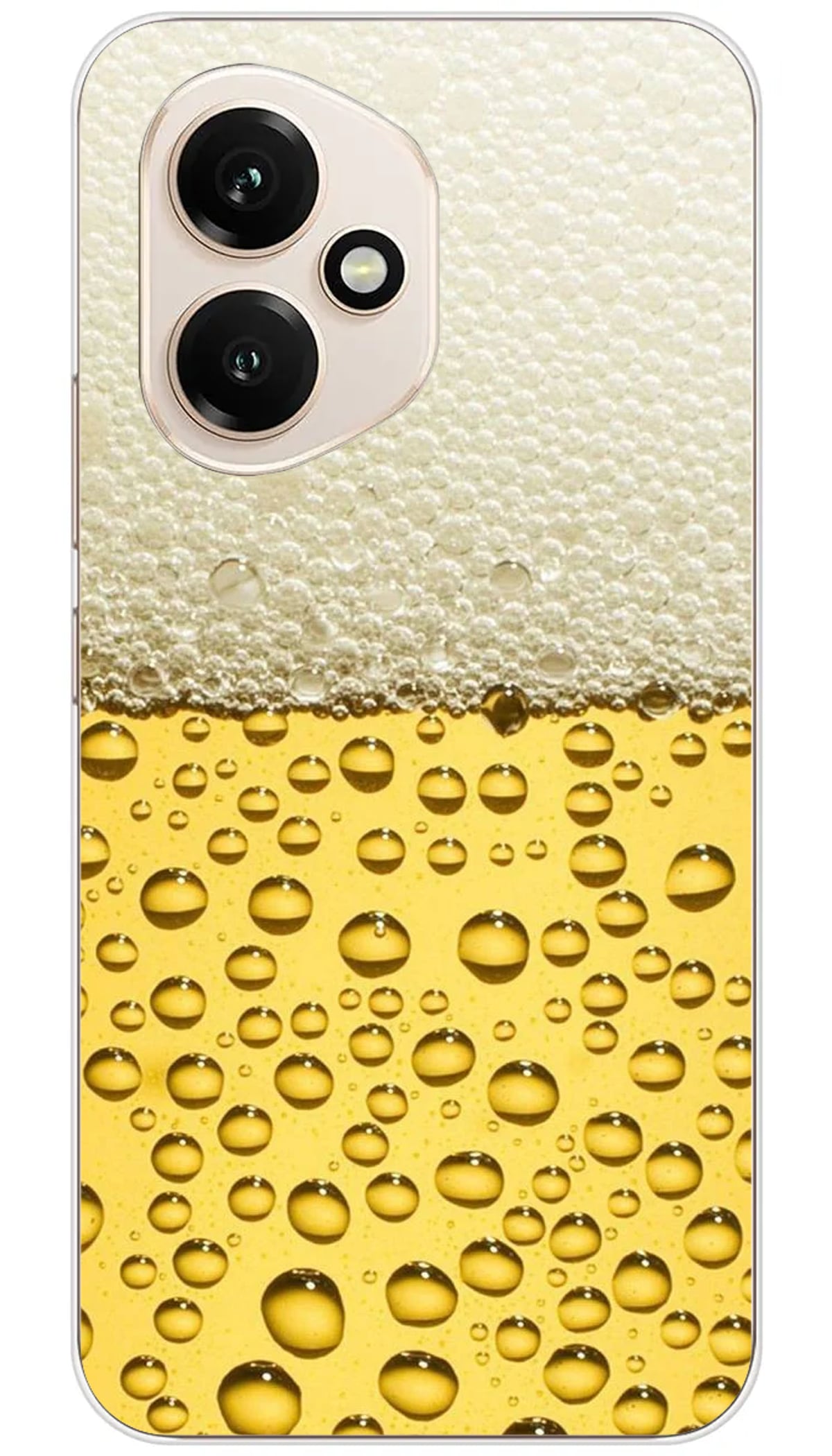 Coque Huawei Pression - Honor 400